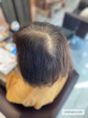白髪染め美容院でのカラー レシピ紹介ナチュラルブラウン 根本before