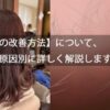 【抜け毛の改善方法】について、美容師が原因別に詳しく解説します。