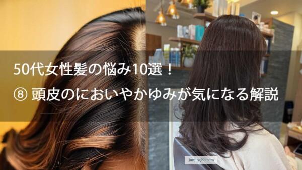 50代女性髪の悩み10選！⑧ 頭皮のにおいやかゆみが気になる解説